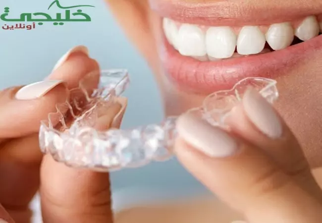 قوالب تبييض الاسنان المنزلي